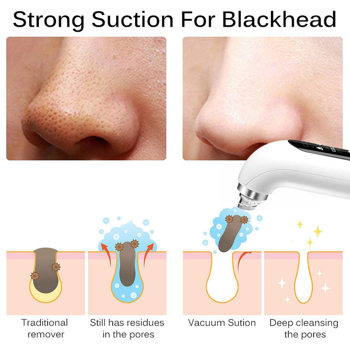 Blackhead Remover Pore Vacuum Face Cleaner Blue Sky